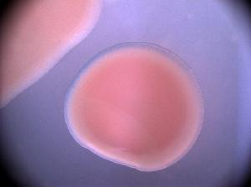 Представитель Класса Mixiomycetes